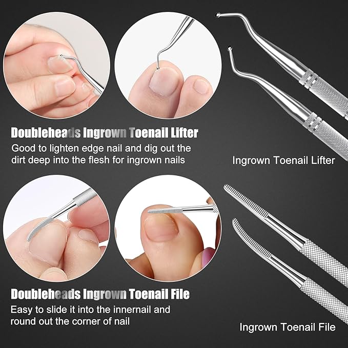 7-Piece Ingrown Toenail Treatment Set, Professional Stainless Steel Ingrown Toenail Removal Kit, Toenail Clippers for Thick Toenails, Pedicure Tools for Feet, Nail Clippers for Thick and Ingrown Nails