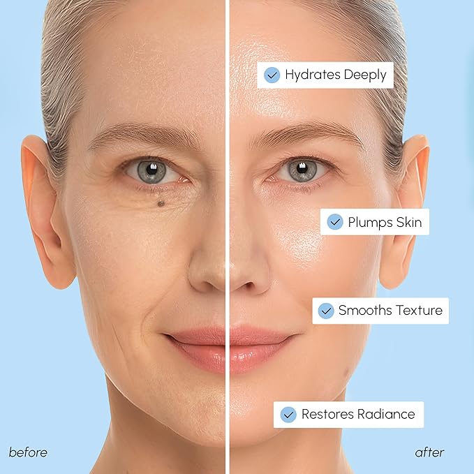 MAREE Hyaluronic Acid Toner Pads - Hydrating Face Wipes for Women Cleansing - Zero Pore Toning Brightening Exfoliating Face Pads - Pore Reducer Facial Peels - Acne Treatment Device