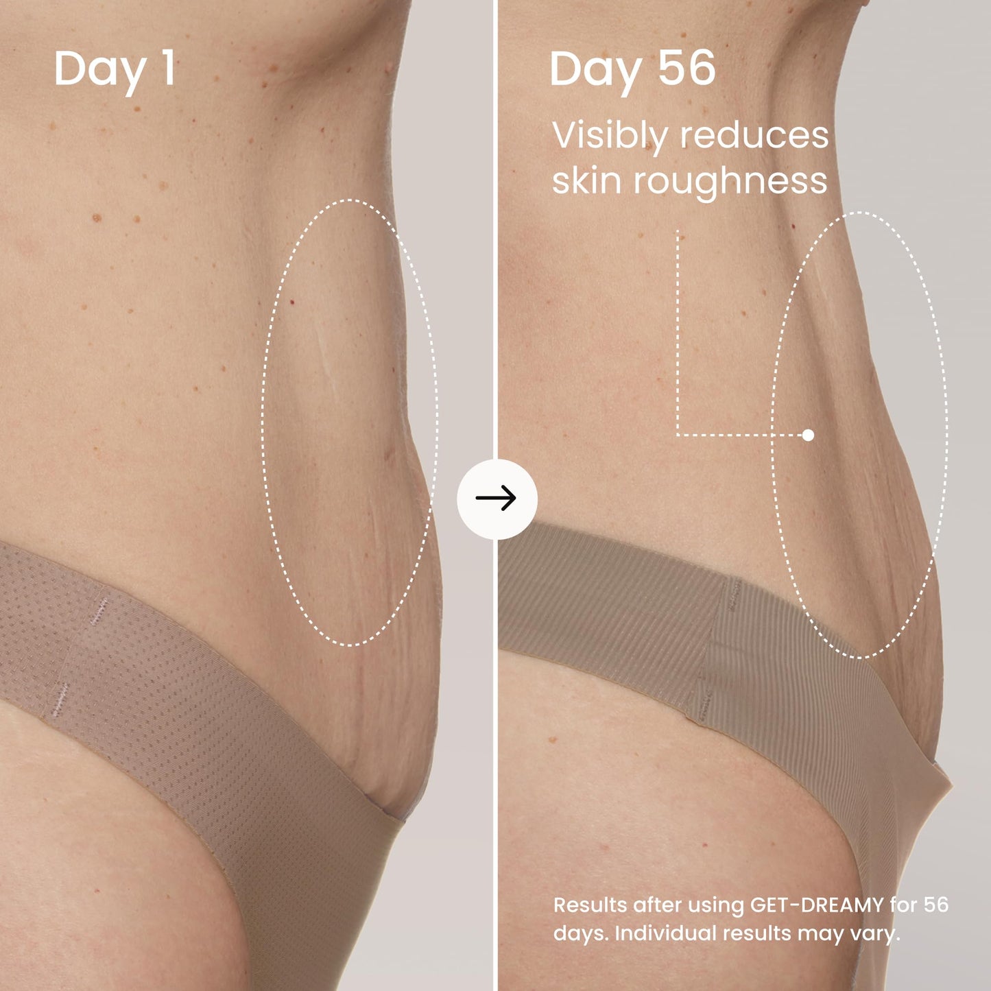 MAËLYS GET-DREAMY Overnight Toning Whip - Cellulite Cream & Skin Tightening Support with Milk Thistle + Uva-Ursi - Moisturizing Body Cream in a Whipped Texture (2 Pack)