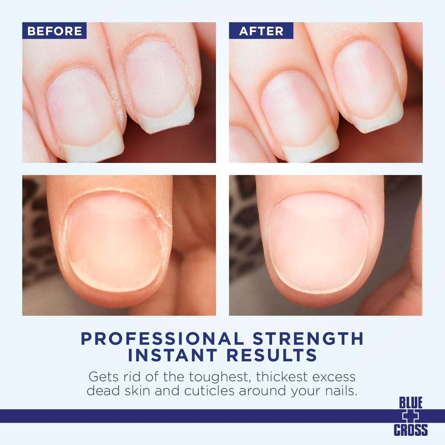 Blue Cross Hydrating, Moisturizing, Strengthening Cuticle Remover Oil with Lanolin + Extra Strength Callus Remover Gel for Heel or Feet, 6 oz each, 2 pack Bundle