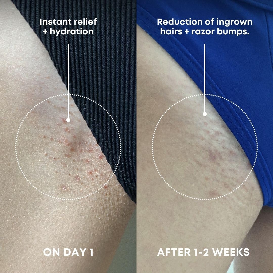 Bushbalm Ingrown Hair Exfoliating Scrub – Pre-Shave Sugar Scrub for Ingrown Hairs, Razor Bumps & Dry Skin – Gently Buffs & Soothes Sensitive Skin - Watermelon Sugar 236ml