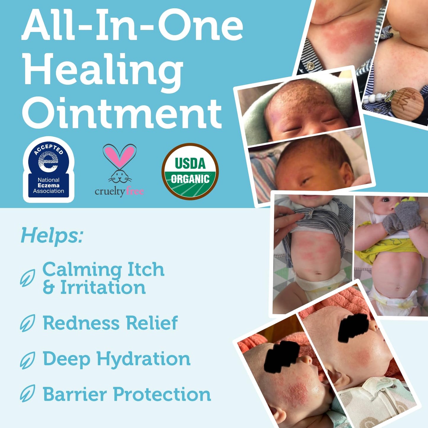 Era Organics Healing Ointment for Babies - USDA Certified Organic Natural Moisturizer Gentle on Sensitive Skin Prone To Baby Eczema, Cradle Cap (Infant Seborrheic Dermatitis), Rashes, Hives - 4oz