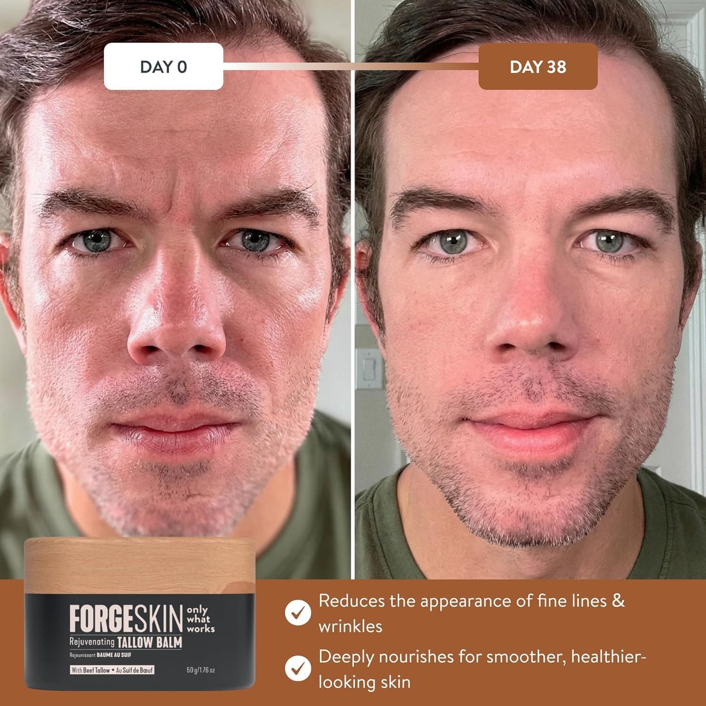 Forge Skin® Wrinkle Defense Beef Tallow Balm for Men [TALLOW-BASED] Moisturizer for Face Hydration - Hydrating Anti Aging Skin Cream - Natural Facial Skincare Lotion with Essential Oils (1.7 OZ)