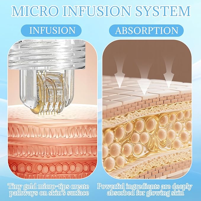 Micro Needling Kit for Face - Micro Infusion System for Face with Hyaluronic Acid & Collagen - Moisturizing & Anti-Wrinkle Facial Serum for All Skin Types - 1 Roller + 4 Serums