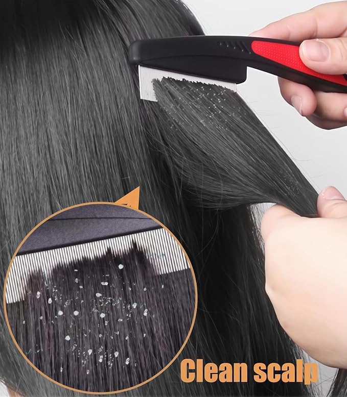 Dandruff Comb Fine Tooth Scalp Detox Comb Lice for Women, Men & Kids Stainless Steel Scalp Detoxing, Sweep & Massage Hair Brush Tool for Hair Care (1PC Red)