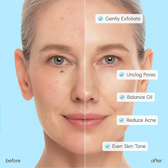MAREE Glycolic Acid Pads & 2% Salicylic Acid Ã¢ÂÂ Toner Pads for Face with 20% Glycolic Acid Solution Ã¢ÂÂ Face Exfoliating Pads, Acne Clearing Face Pads Ã¢ÂÂ Skin Pore Resurfacing & Radiance Device Ã¢ÂÂ 50 Count