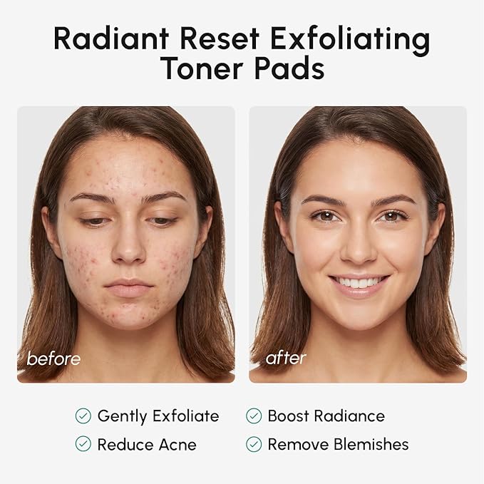 MAREE Glycolic Acid Resurfacing Pads - Toner Pads for Face Cleansing - Exfoliating Pad with Tea Tree Oil, Salicylic Acid & Vitamins E, B3, B5 - Acne Treatment Device for Pore Resurfacing - 50 Count