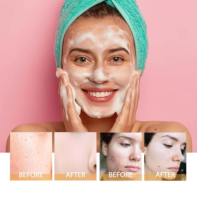 Axnzp Turmeric Facial Cleanser, Deep Cleansing Exfoliating Glow Wash Turmeric Face Wash With Brush for Women All Skin.