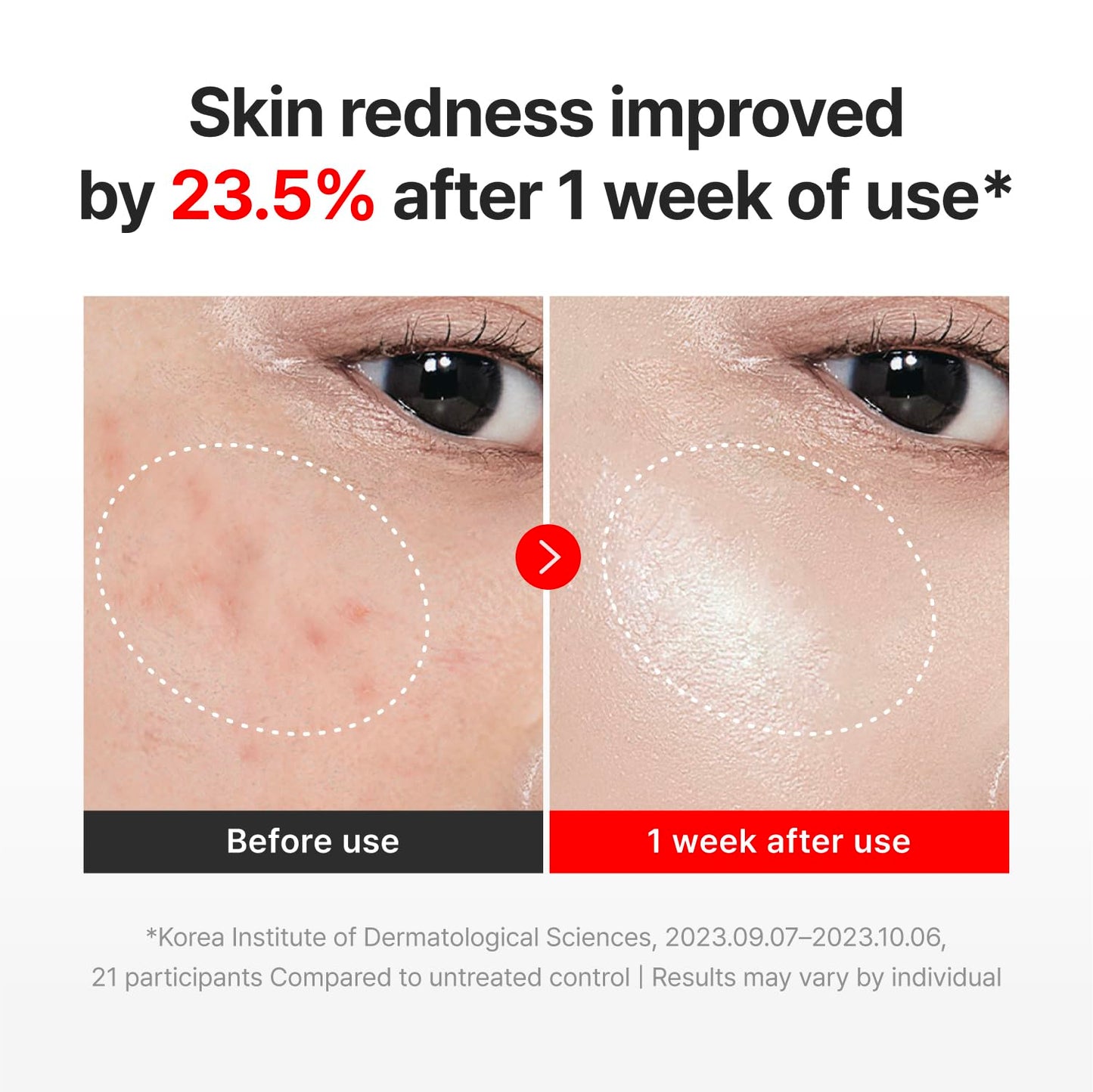 CENTELLIAN 24 Madeca Cream Time Reverse (1.69 fl oz) - TECA Centella Asiatica Glow Face Cream Moisturizer, Hydrating, Firming, Smoother Even-Looking Skin, Helps Improve Skin Elasticity,Korean Skincare