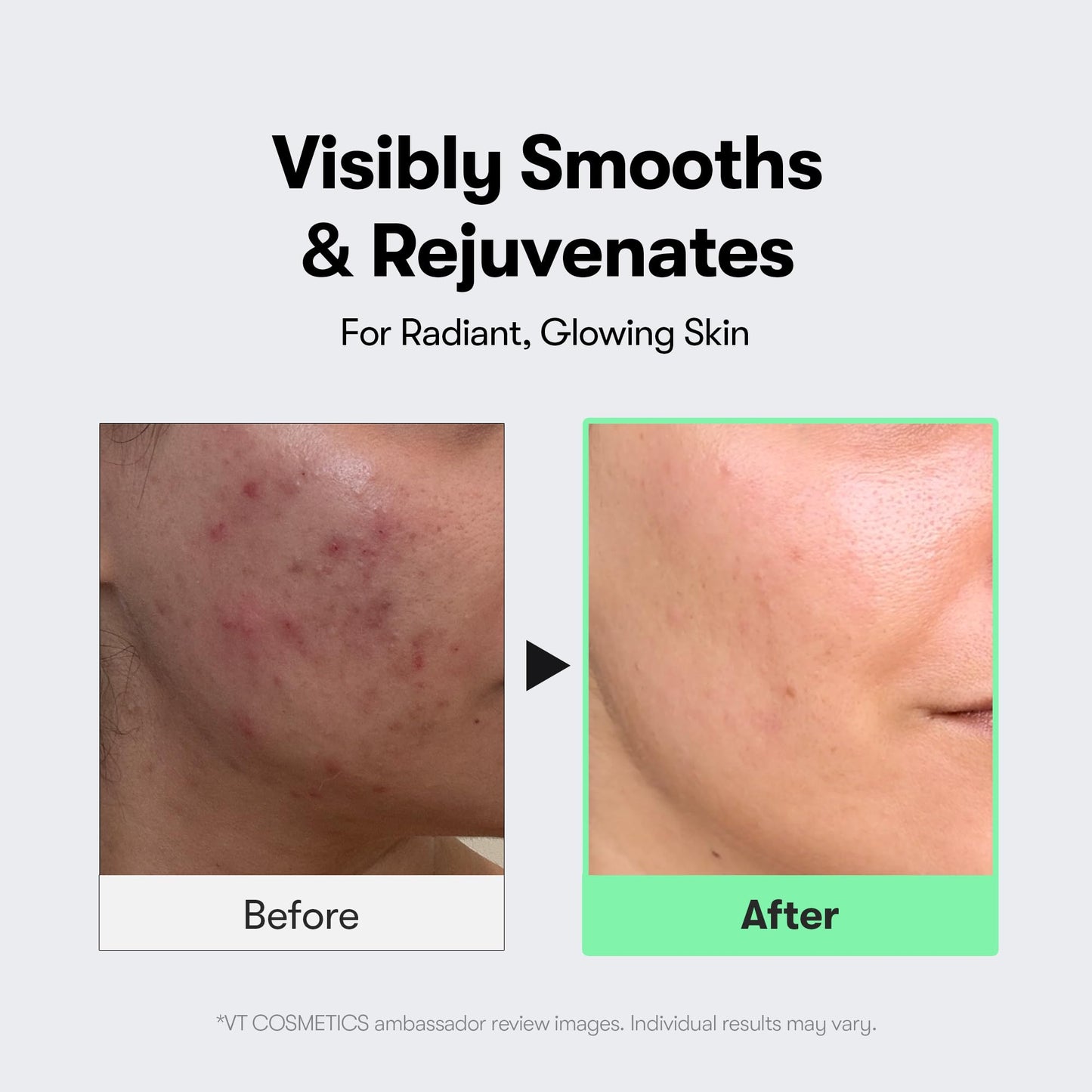 VT COSMETICS CICA Reedle Shot 50, Spicule Microneedling Serum for Pore Care & Exfoliation, Exosome, Centella Asiatica for Glass Skin, Smooth Texture, Korean Liquid Skin Booster (1.69 Fl Oz / 50ml)