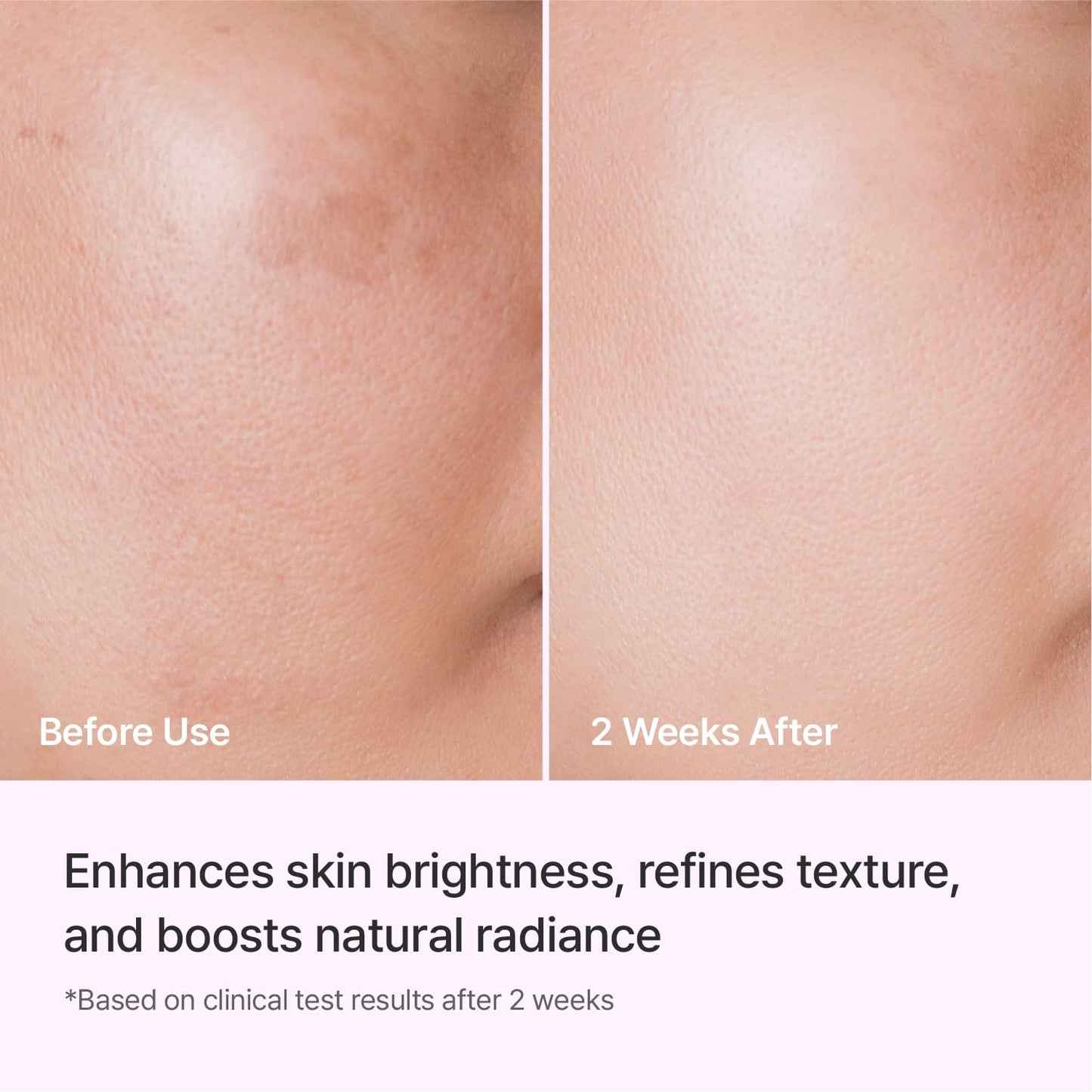 REJURAN® Triple Radiance Ampoule 30ml – DOT™ c-PDRN 0.5% Serum for Tone, Texture & Glow - Niacinamide & Licorice Extract for Even-Looking Skin
