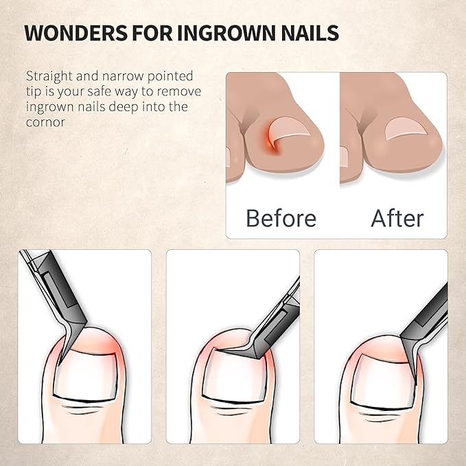 FERYES Toenail Clipper Straight Blade for Ingrown and Thick Nails - Stainless Steel and Sharp Pointed Tip Ingrown Nail Clipper – Wide Jaw Toe Nail Cutter Ingrown Tool