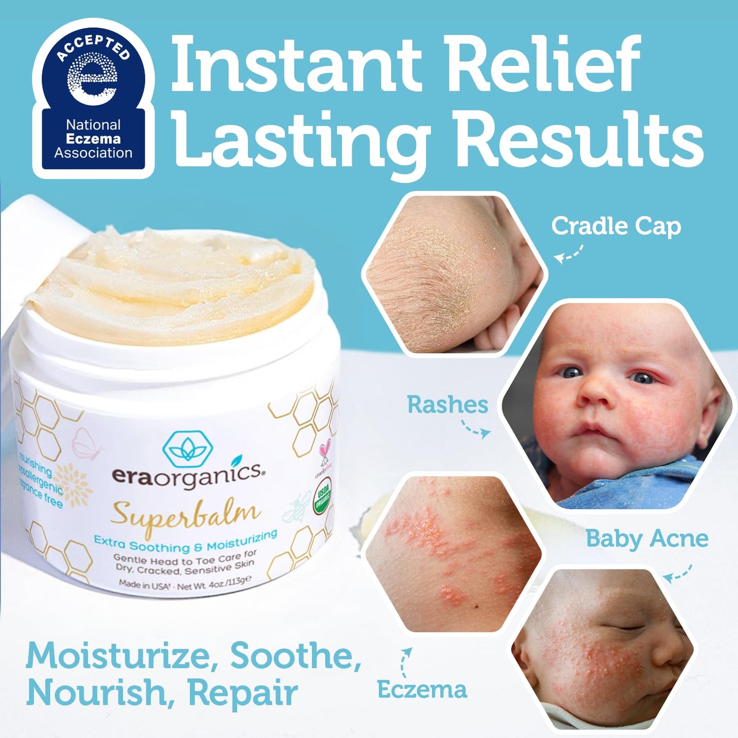 Era Organics Healing Ointment for Babies - USDA Certified Organic Natural Moisturizer Gentle on Sensitive Skin Prone To Baby Eczema, Cradle Cap (Infant Seborrheic Dermatitis), Rashes, Hives - 4oz