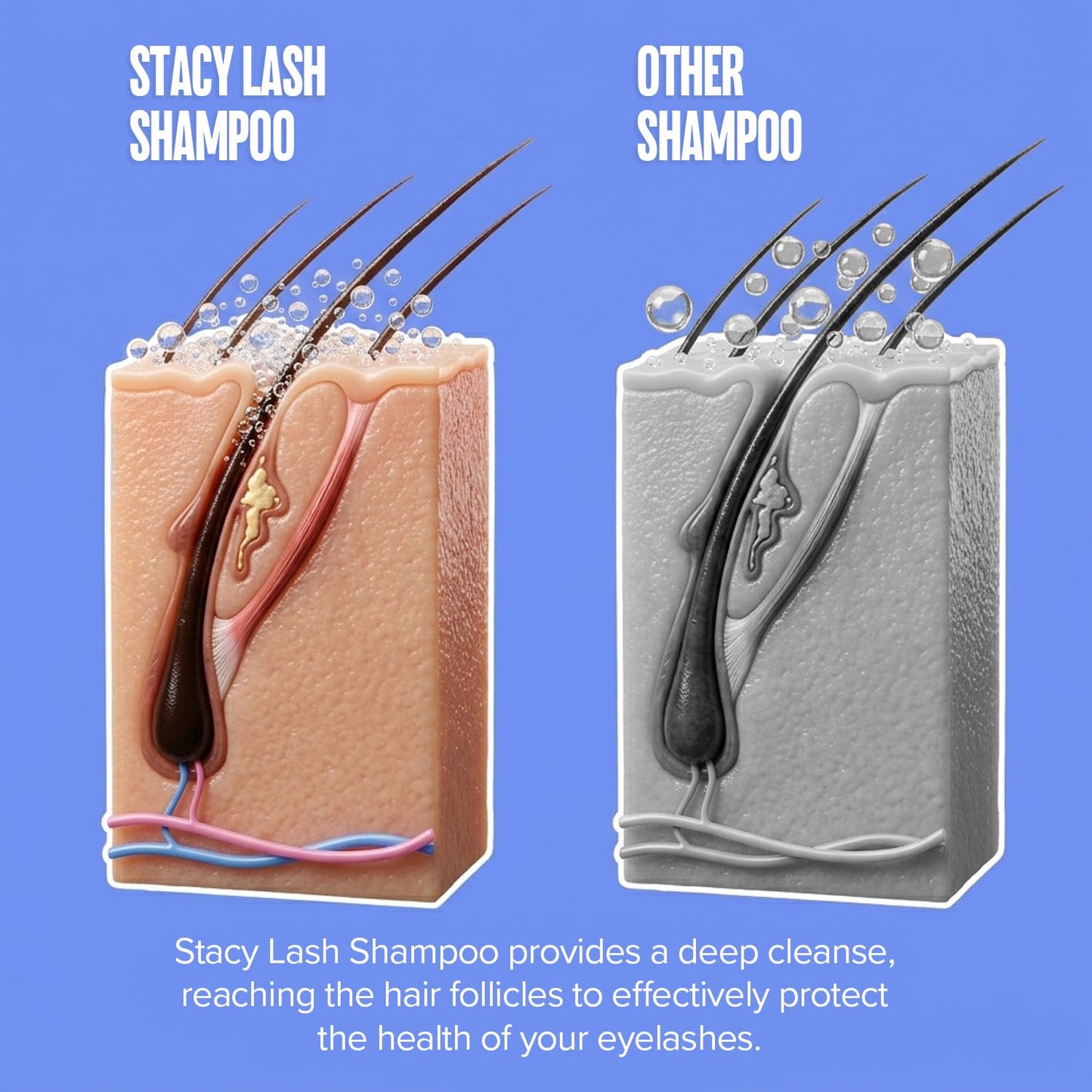 STACY LASH Eyelash Extension Shampoo + Brush / 1.69 fl.oz / 50ml / Eyelid Foaming Cleanser/Wash for Extensions & Natural Lashes/Safe Makeup Remover/Supplies for Professional & Home Use