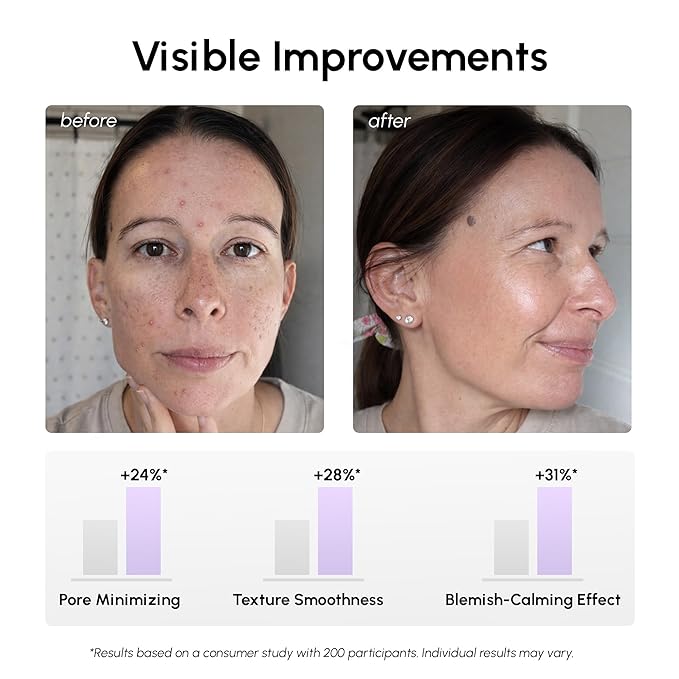 MAREE Niacinamide Toner Pads for Face Ã¢ÂÂ Exfoliating Pads with 12% Niacinamide, Salicylic Acid, Hyaluronic Acid & Tea Tree Ã¢ÂÂ Zero Pore, Uneven Skin Tone, Acne Clearing Facial Pads Ã¢ÂÂ Glow Up Device