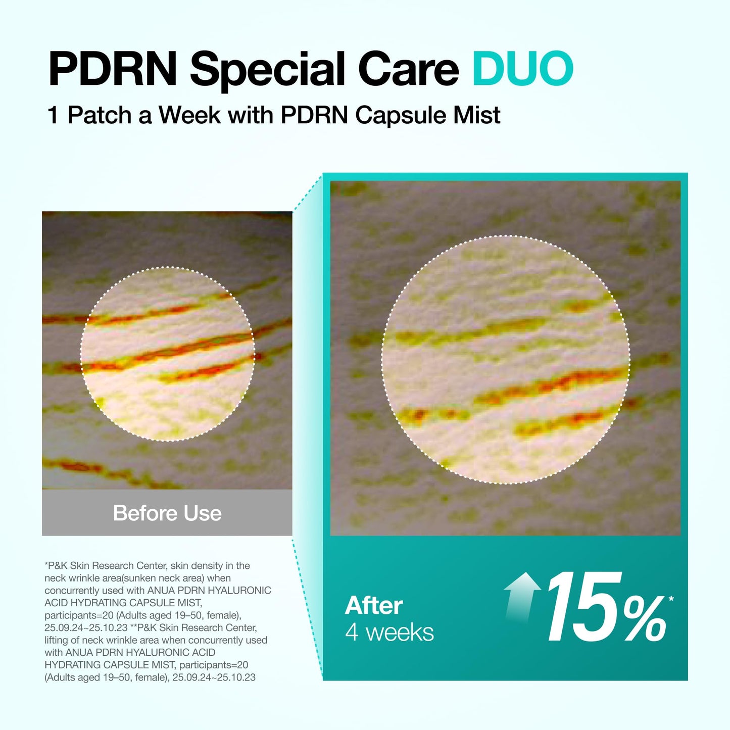 Anua PDRN Collagen Melting Patch for Neck, Lifting and Firming, Thin Film Patch for Neck Fine Lines & Forehead, Plumping Effect with Salmon DNA, Korean Skincare, 0.02g x 4EA