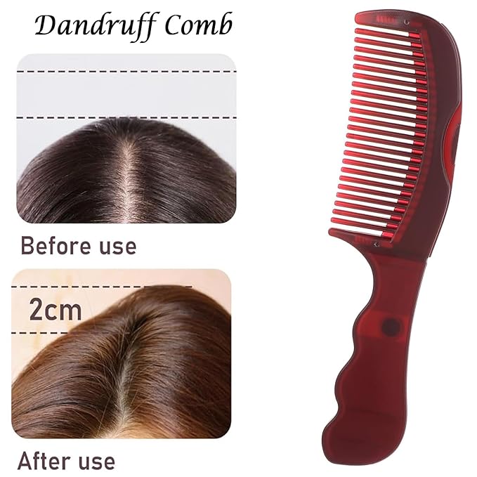 Dandruff Comb, Hollow Tooth Button Comb, Detoxing Comb Energy Massage Comb, Scalp Psoriasis Comb Dandruff Removal Comb, Lice Comb Multifunctional Hairbrush (Red 1PC)