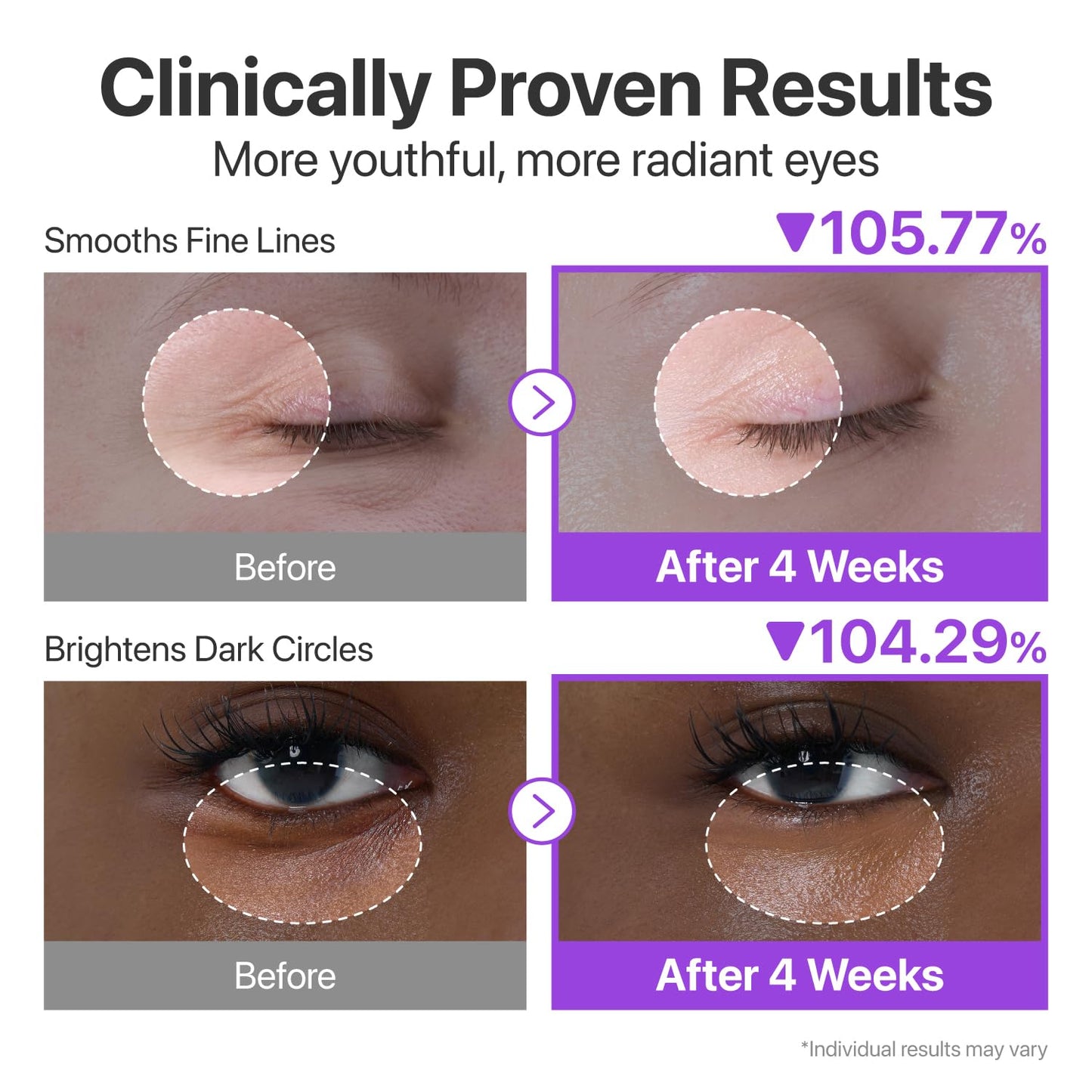 numbuzin No.9 NAD+ Retinol Eye Cream, Depuffing & Firming Eye Serum for Dark Circles, Wrinkles & Fine Lines, Peptides & Niacinamide for Glow & Undereye Radiance, Stocking Stuffers 0.33 fl oz