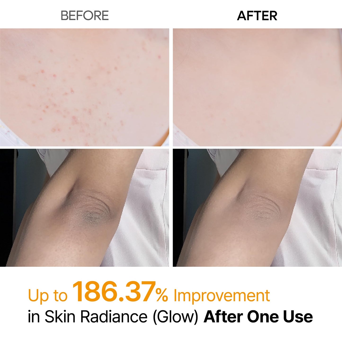 Dr.Melaxin Body Keratin Care Kojic Acid Turmeric Spray with AHA & PHA, Gentle Body Brightening & Exfoliating Peeling Solution for Dead Skin Cells & Texture, Korean Skincare, 6.76 fl.oz