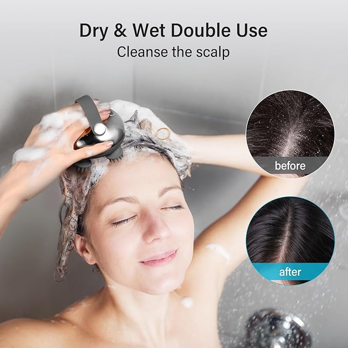 arboleaf Scalp Massager Rechargeable Head Massager Scalp Stress Relax, Waterproof Handheld Hair Scratcher with 8 Removable Massage Claws, Gift for Dad Mom