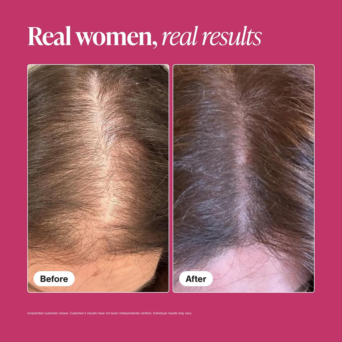 Viviscal Hair Growth Supplements for Women, Thicker Fuller Hair Support for Thinning Hair and Hair Loss, with Biotin and Marine Collagen, Drug-Free, 180 Tablets, 90-Day Supply