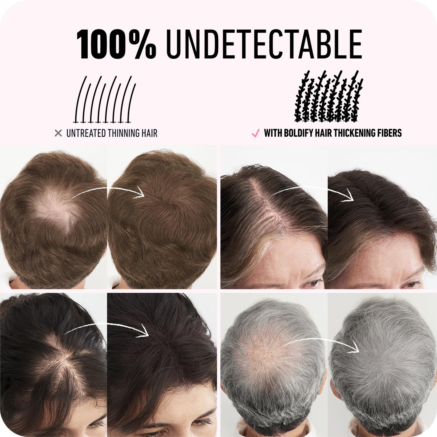 BOLDIFY Hair Fibers (12g) - Fill In Thinning and Fine Hair for an Instantly Fuller, Thicker Look - 14 Shades for Women & Men - Dark Brown