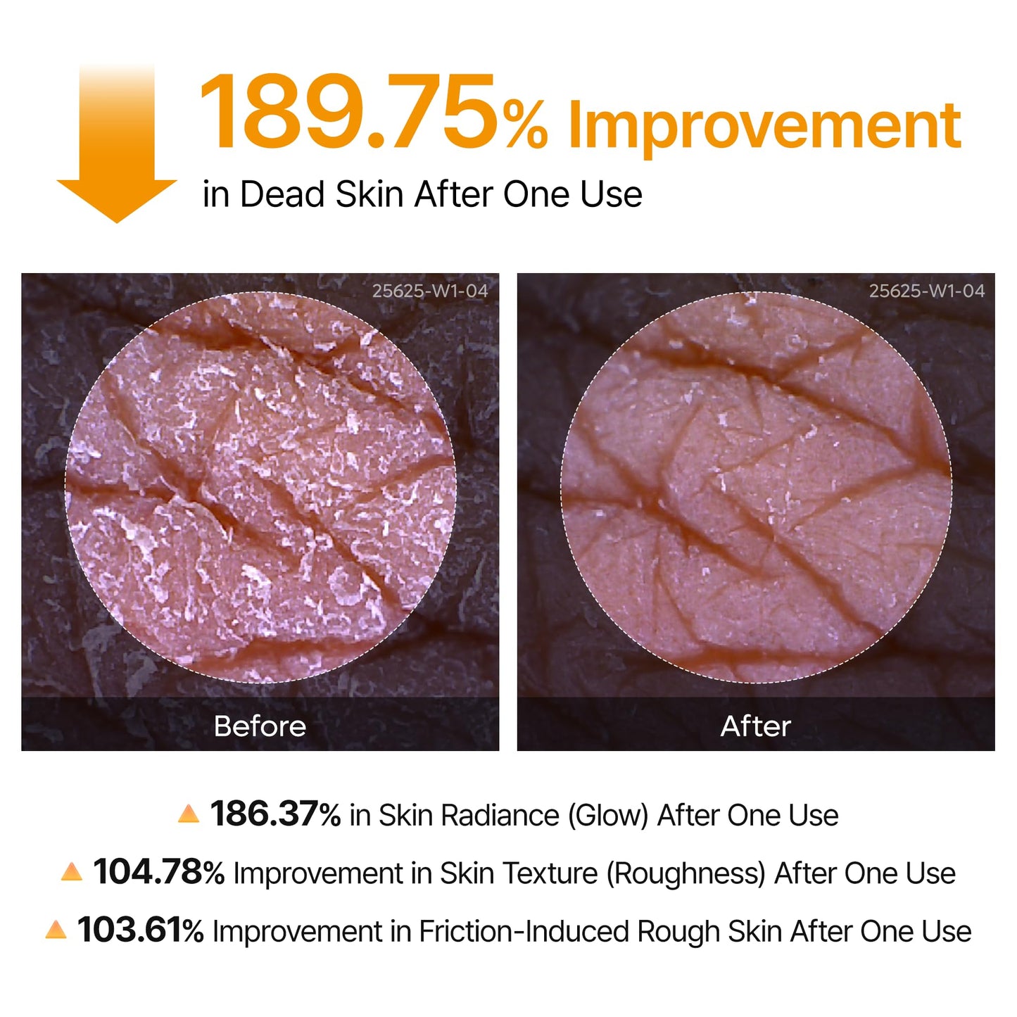 Dr.Melaxin Body Keratin Care Kojic Acid Turmeric Spray with AHA & PHA, Gentle Body Brightening & Exfoliating Peeling Solution for Dead Skin Cells & Texture, Korean Skincare, 6.76 fl.oz