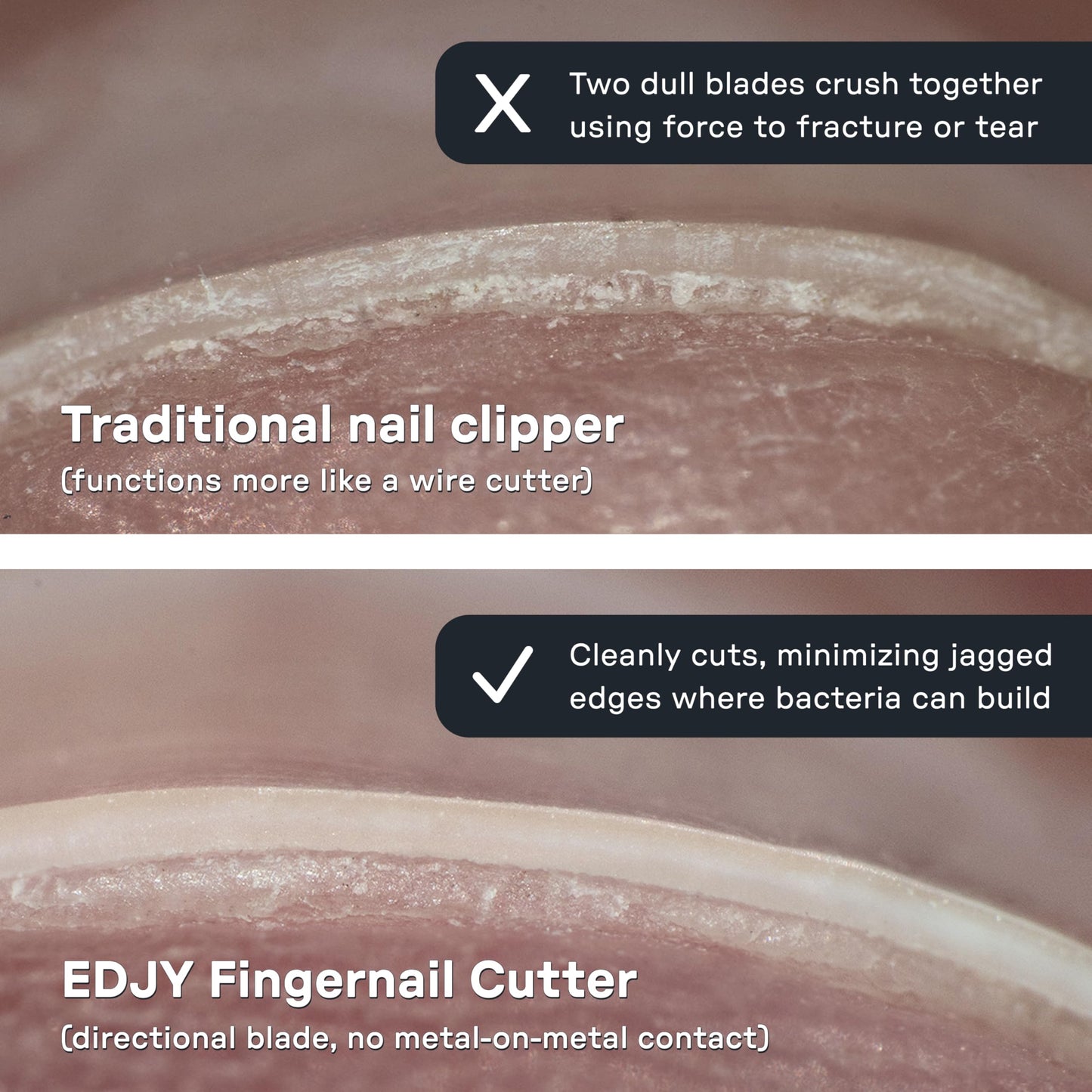 EDJY Fingernail Cutter - Precision Stainless Steel Nail Cutter for Fingernails | Sharp Blade, Ergonomic Design, Durable & Rust-Resistant | Ideal for Men and Women | EDJY Blue