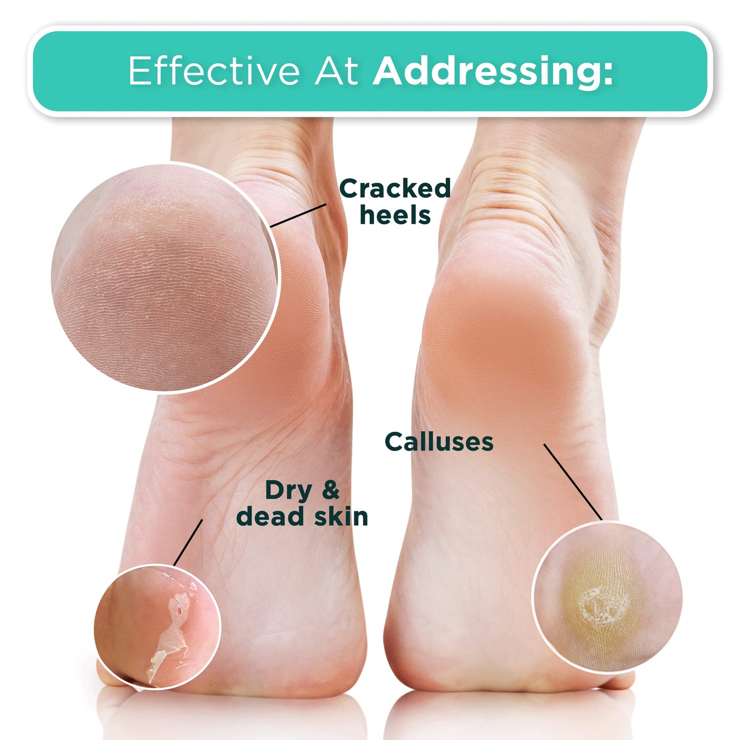DERMORA Foot Peel Mask | Skin Exfoliating Foot Masks for Dry, Cracked Feet & Callus Removal | Dead Skin Exfoliator for Baby Soft Feet | Pack of 2 | Regular (Fits up to Men 10 / Women 11) | Original
