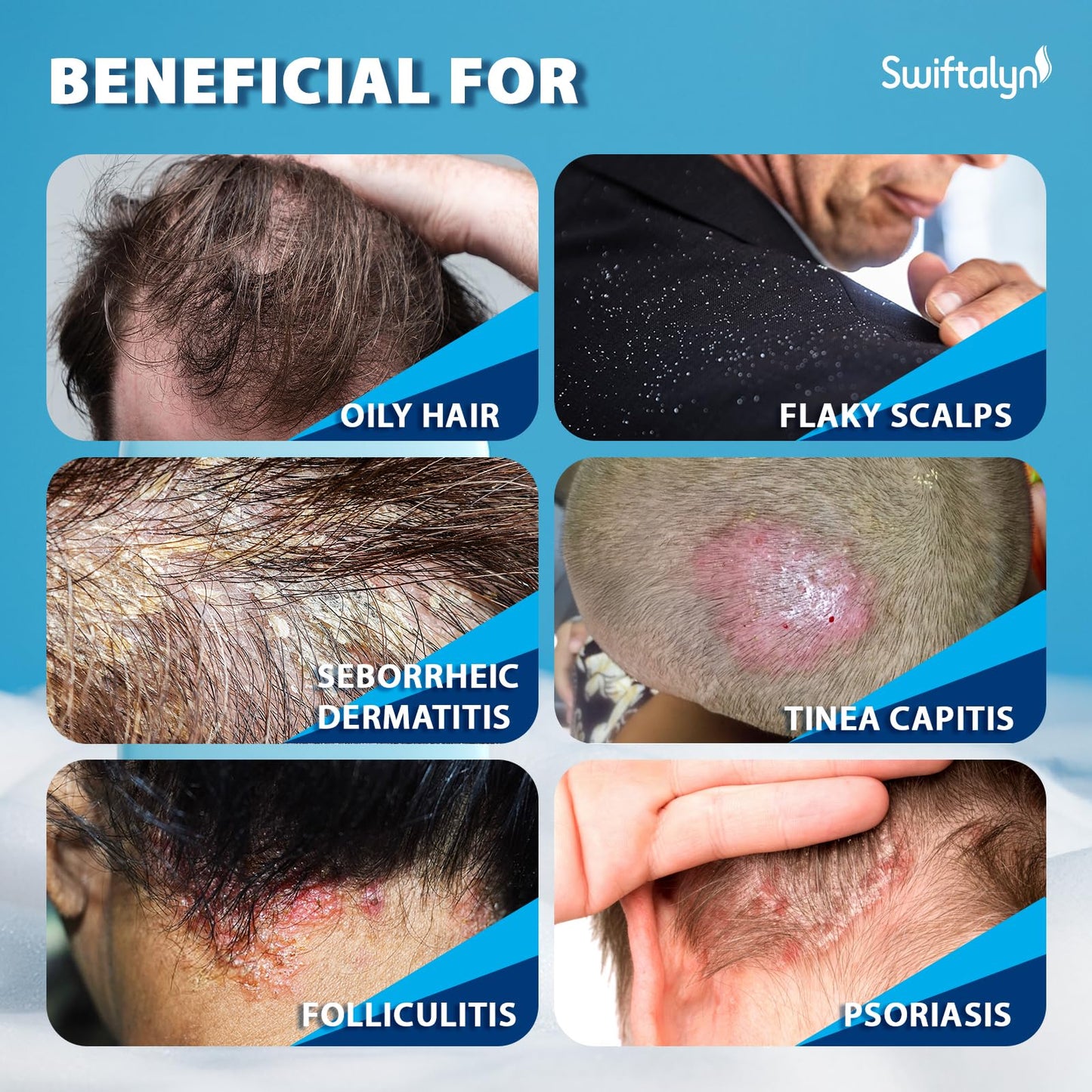 Swiftalyn Scalp Ance Shampoo for Men & Women – Sulfate-Free Formula