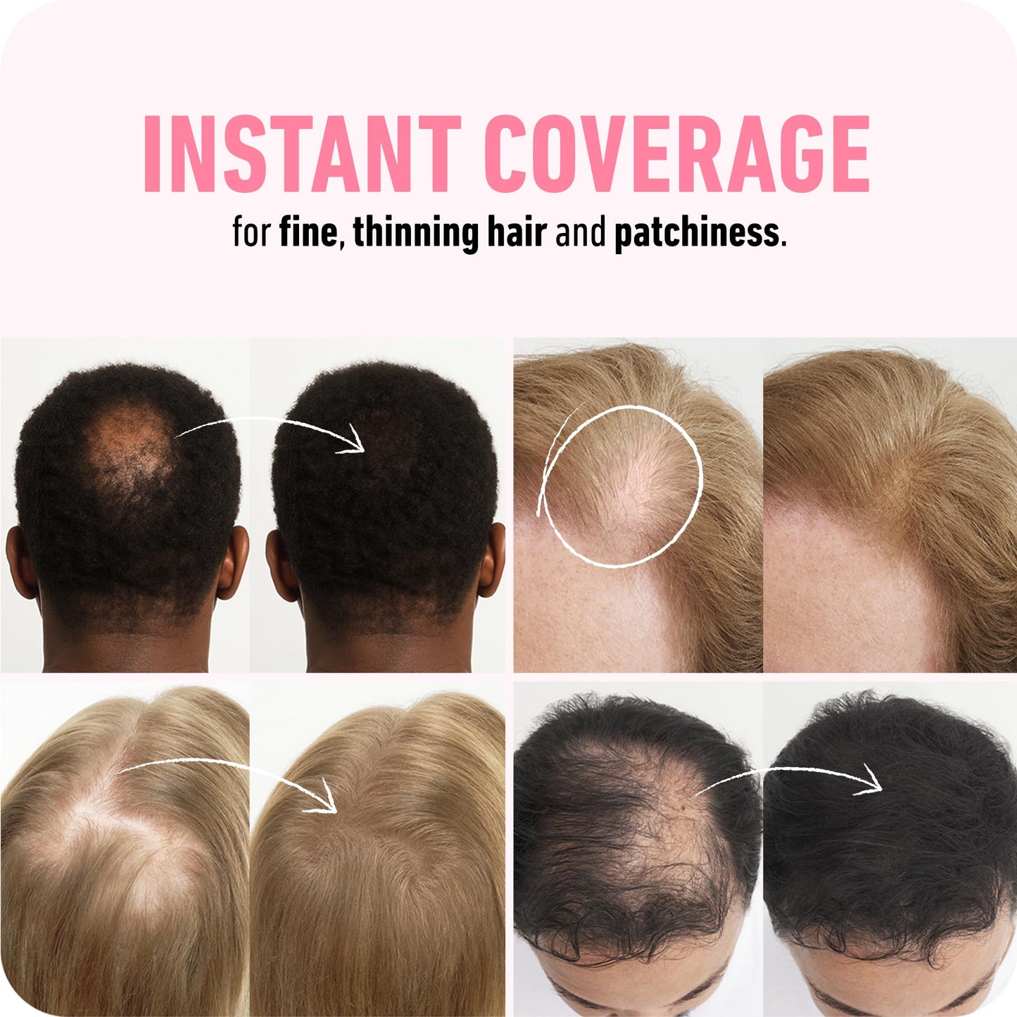 BOLDIFY Hair Fibers (12g) - Fill In Thinning and Fine Hair for an Instantly Fuller, Thicker Look - 14 Shades for Women & Men - Dark Brown