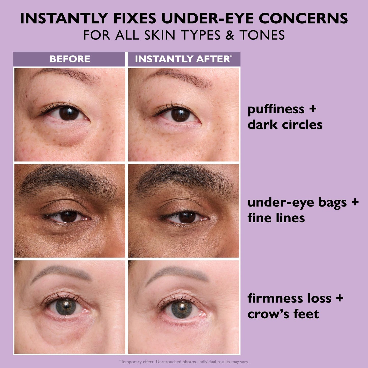 Peter Thomas Roth | Instant FIRMx® Eye Temporary Eye Tightener Easy-Wear Formula | For Firming Under-Eye Bags & Wrinkles