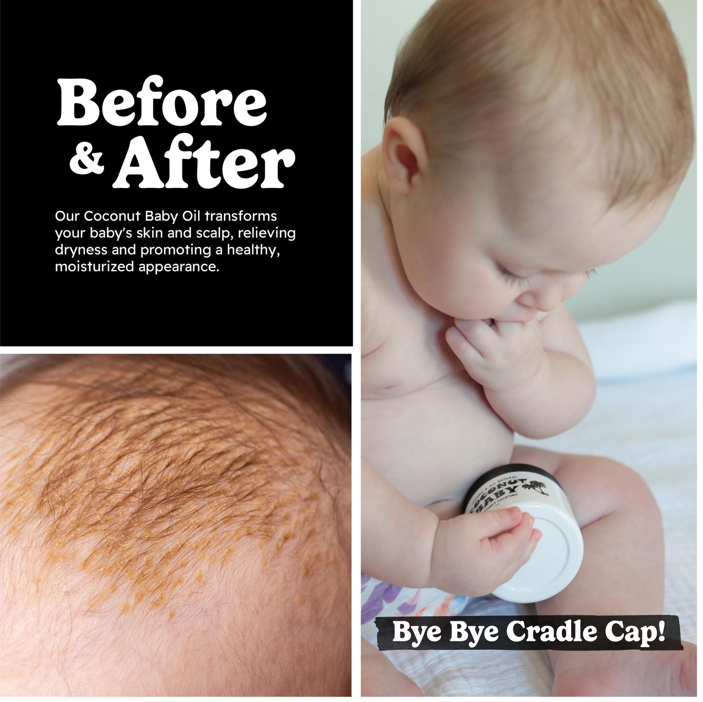 Coconut Essentials COCONUT BABY Oil, Natural & Organic Moisturizer for Newborn Sensitive Skin, Eczema & Psoriasis Relief, Hair Oil for Cradle Cap Treatment, Unscented, Sunflower & Grape Seed 8 fl oz