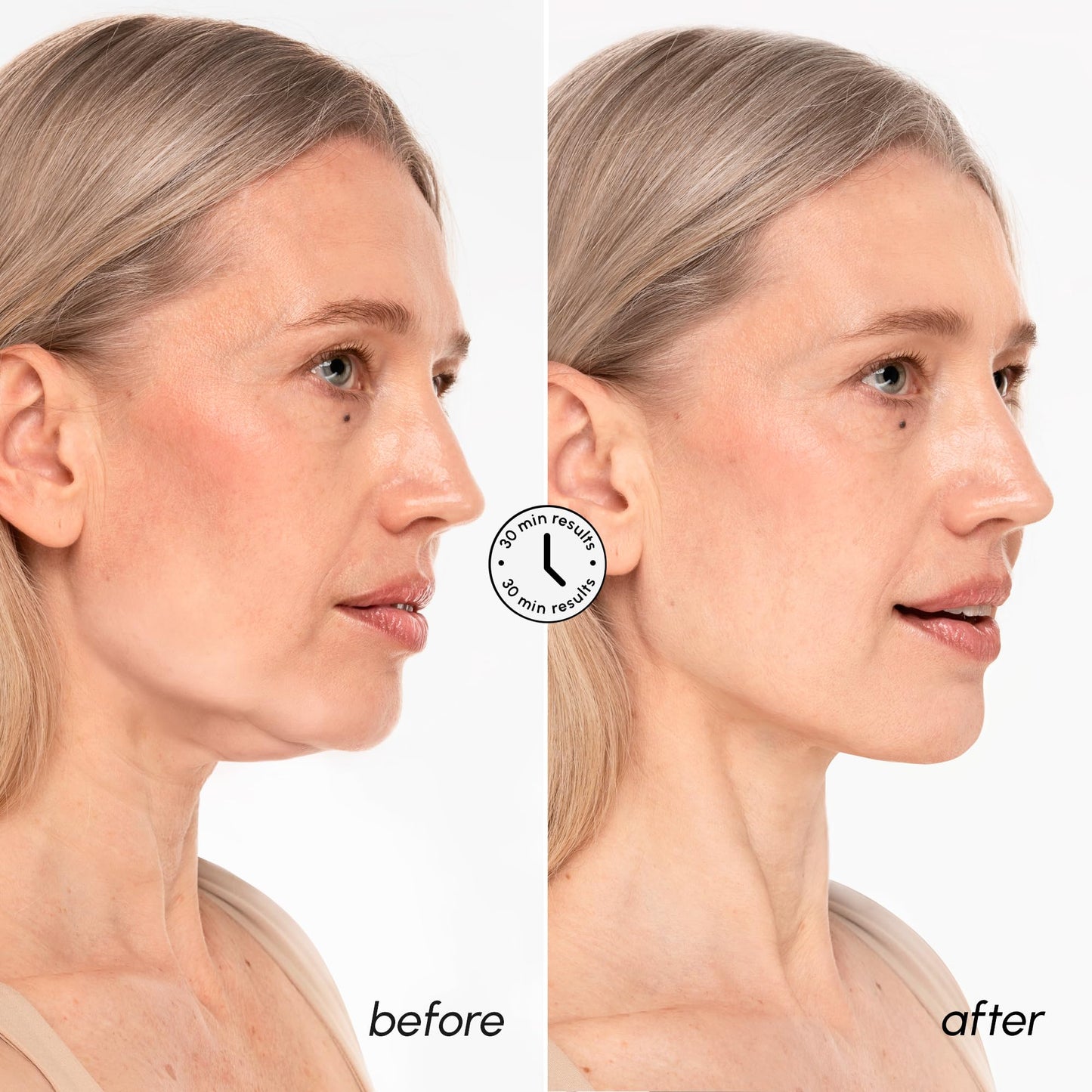 MAREE V Line Lifting Mask with 24K Gold – Deep Collagen Face Mask for Women – Jawline Shaper Mask with Retinol & Hyaluronic Acid – Neck Tightening & Firming - Double Chin Strap for Face Lift