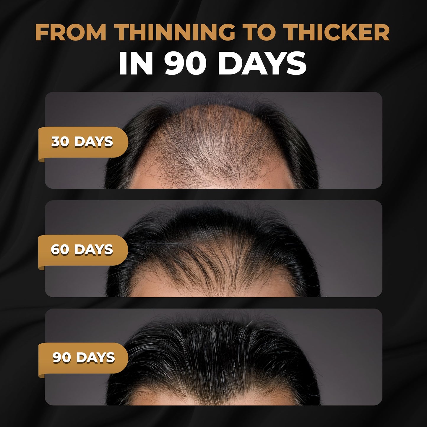 SPARTAN™ Root Activator Shampoo For Men - Hair Growth Shampoo for Hair Loss and Thinning Hair