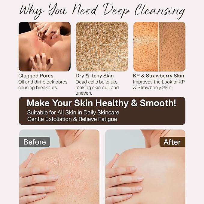 Exfoliating Gloves, Exfoliating Body Scrubber for Bath Shower Exfoliation, Body Scrub Exfoliator Loofah Sponge for Dead Skin Remover Pink+Rose