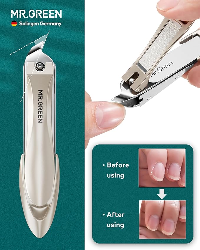 MR.GREEN Manicure Pedicure Kit 8-in-1, Upgraded Anti-Splash Nail Clippers Set, German Stainless Steel Full-Function Nail Grooming Kit with Real Leather Case for Women & Men, IdealGift