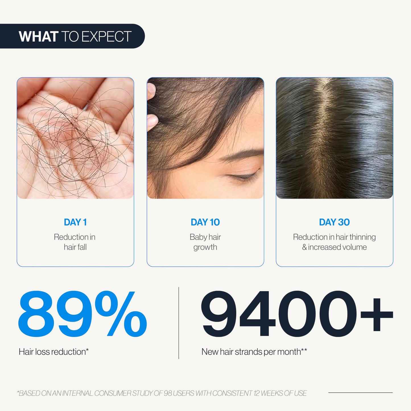 Be Bodywise Hair Growth Serum Roll On - 5% Saw Palmetto, 3% Rosemary Oil for Hair Growth, 3% Fenugreek,1% Caffeine Herbasome | Serum for Hair Loss & Hair Regrowth For Men & Women 25ml/0.84 fl oz