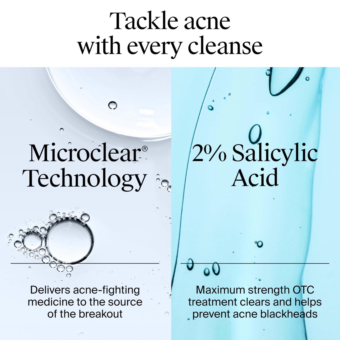 Neutrogena Oil-Free Acne Wash, Acne Fighting Facial Cleanser with Salicylic Acid Medicine, Acne Treatment for Face, Non-Comedogenic, Residue-Free, 9.1 fl oz Pump Bottles, 3 Pack