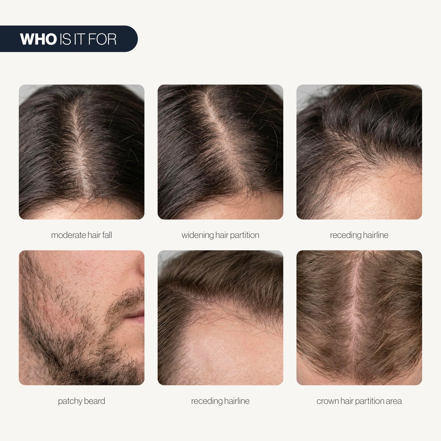 Be Bodywise Hair Growth Serum Roll On - 5% Saw Palmetto, 3% Rosemary Oil for Hair Growth, 3% Fenugreek,1% Caffeine Herbasome | Serum for Hair Loss & Hair Regrowth For Men & Women 25ml/0.84 fl oz