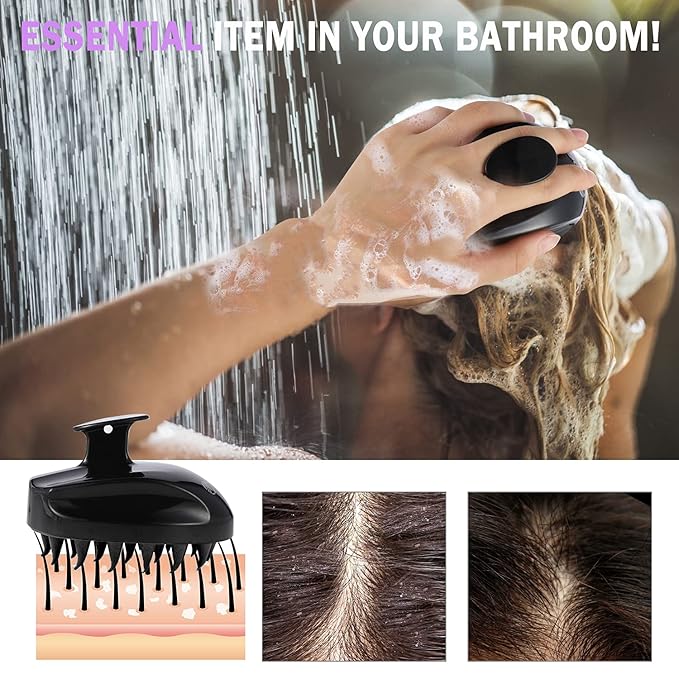 Sosoon Scalp Massager Shampoo Brush, Hair Scalp Scrubber Shower Hair Brush Head Massager for Stress Relax Hair Growth, Dandruff Brush Scalp Exfoliator for Women Men Kids Pets, Black