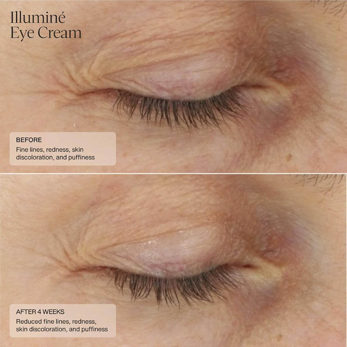 Senté Illuminé Eye Cream | Diminish Dark Circles, Discoloration, Redness, and Puffiness Around The Eyes | with Patented HSA, Niacinamide and Peptides | 0.5 Oz