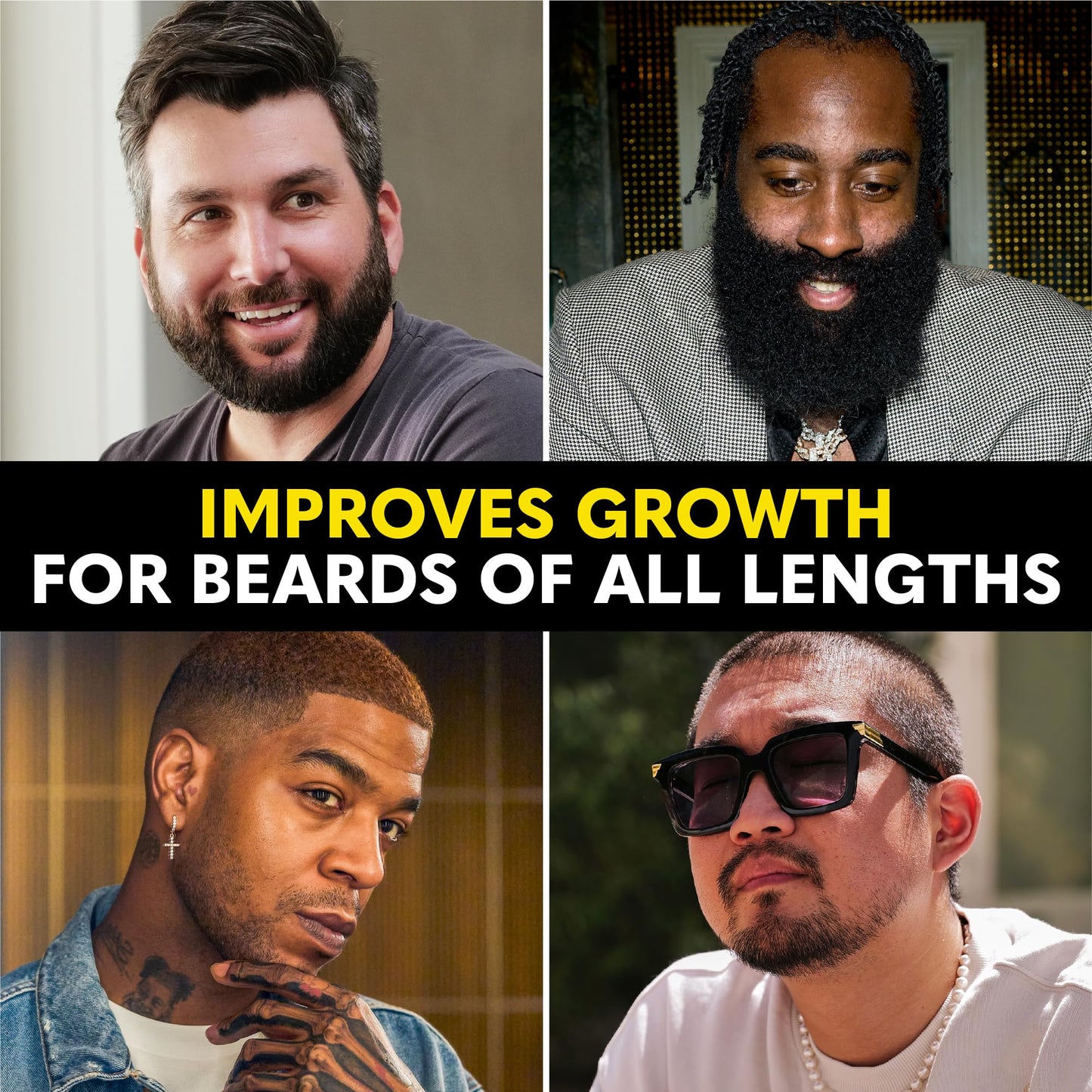 Beard Club - Beard Growth Serum with Natural Castor, Coconut and Avocado to Grow a Thicker, Fuller Beard, Fill in Patches and Stimulate Healthier Facial Hair Growth